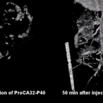 Protein-Based MRI Contrast Agent Enhances Liver Cancer Detection