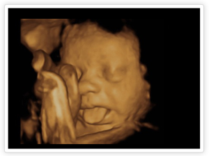 Amazing Ultrasound Photos and Videos - StudyPK