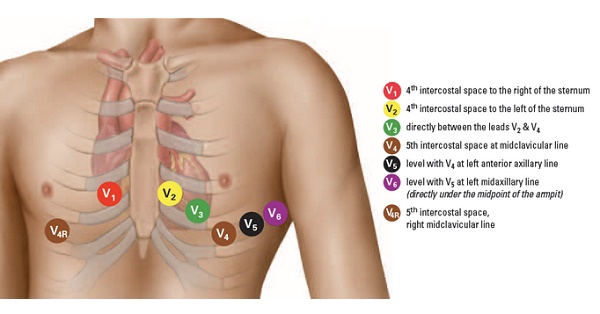 How To Read An EKG - StudyPK