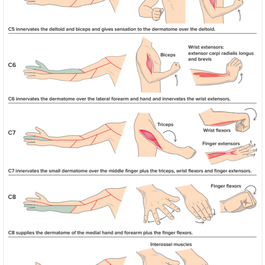 C5 C6 Cervical Radiculopathy Pinched Nerve Stretches - vrogue.co