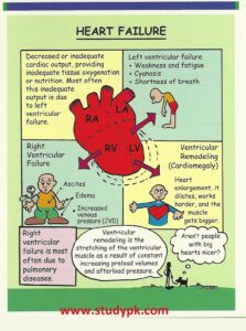 Nursing Left Sided Heart Failure - StudyPK