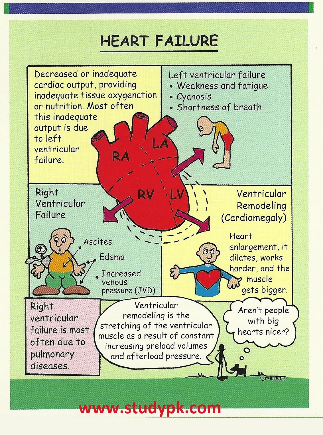 Nursing Left Sided Heart Failure Studypk Vrogue