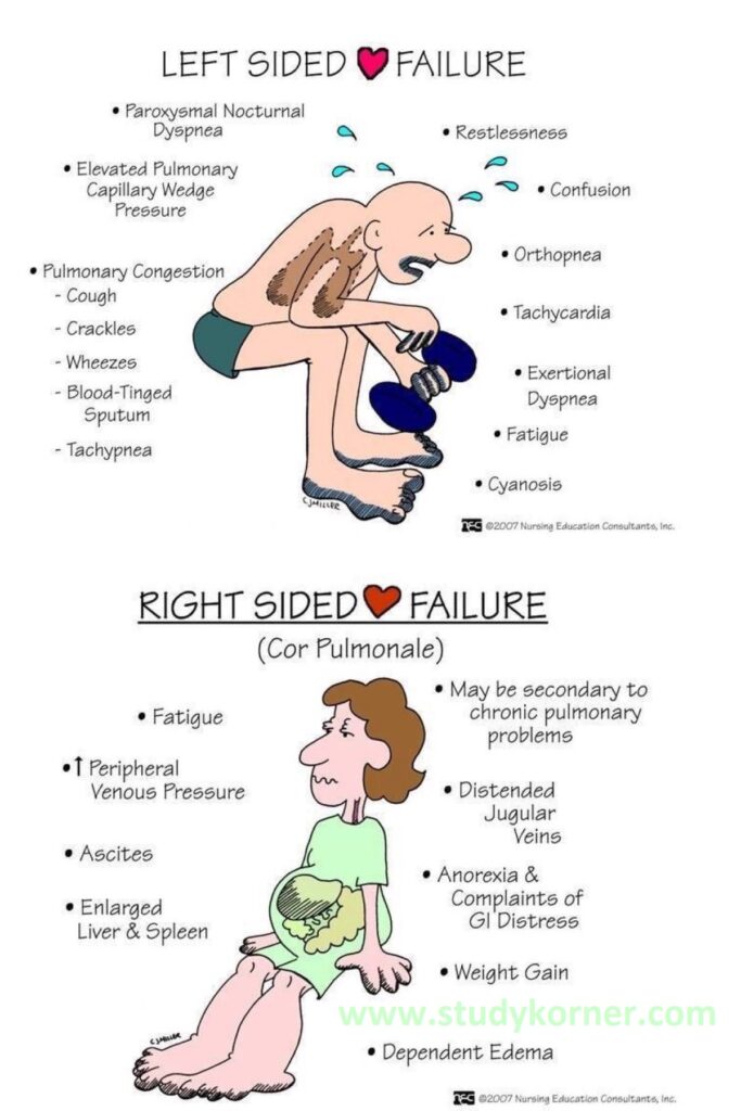 nursing-left-sided-heart-failure-studypk