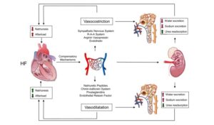 Next Gen NCLEX Quiz: Heart Failure and Fluid Overload - StudyPK