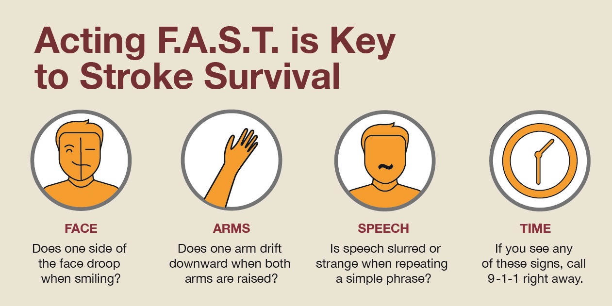 Nursing Quiz Test Your Knowledge Of Stroke Like Symptoms Studypk