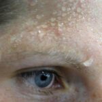 Identifying the Cause: Excessive Sweating and Clammy Skin - A NCLEX Quiz
